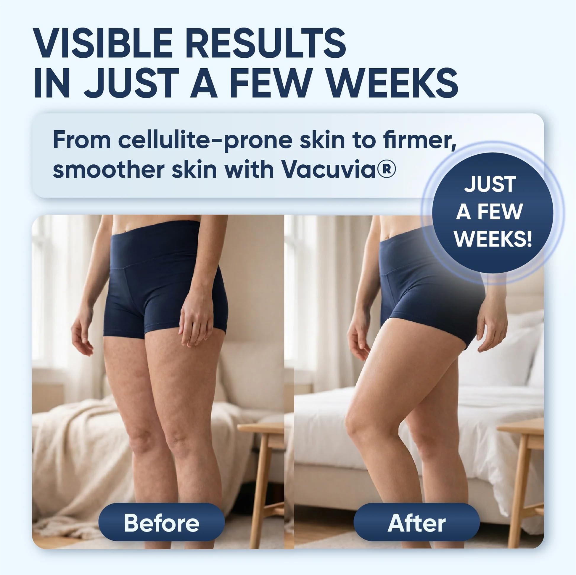 Vacuvia Massaggiatore Anticellulite Elettrico, Coppettazione e Gua Sha per Drenaggio Linfatico e Rimodellamento Corpo