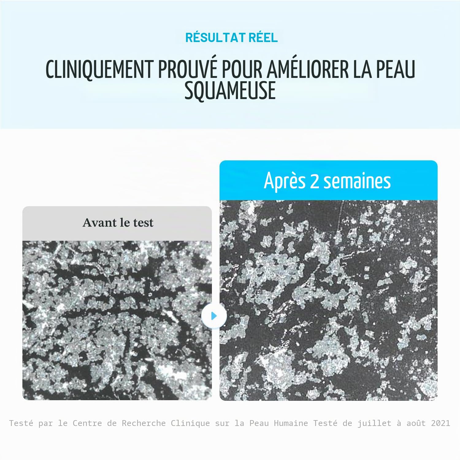 EQQUALBERRY Swimming Pool Toner 155ml – Lotion Tonique Visage Hydratante aux Enzymes Naturelles et Acide Hyaluronique – Exfoliation Douce pour Peau Lisse et Confortable