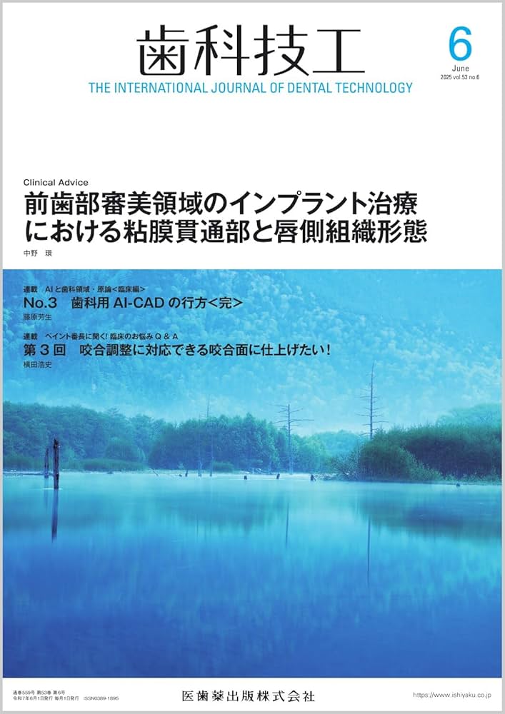 歯科技工別冊　前歯部審美技工テクニカルガイド シエン社 | 前歯部審美技工テクニカルガイド