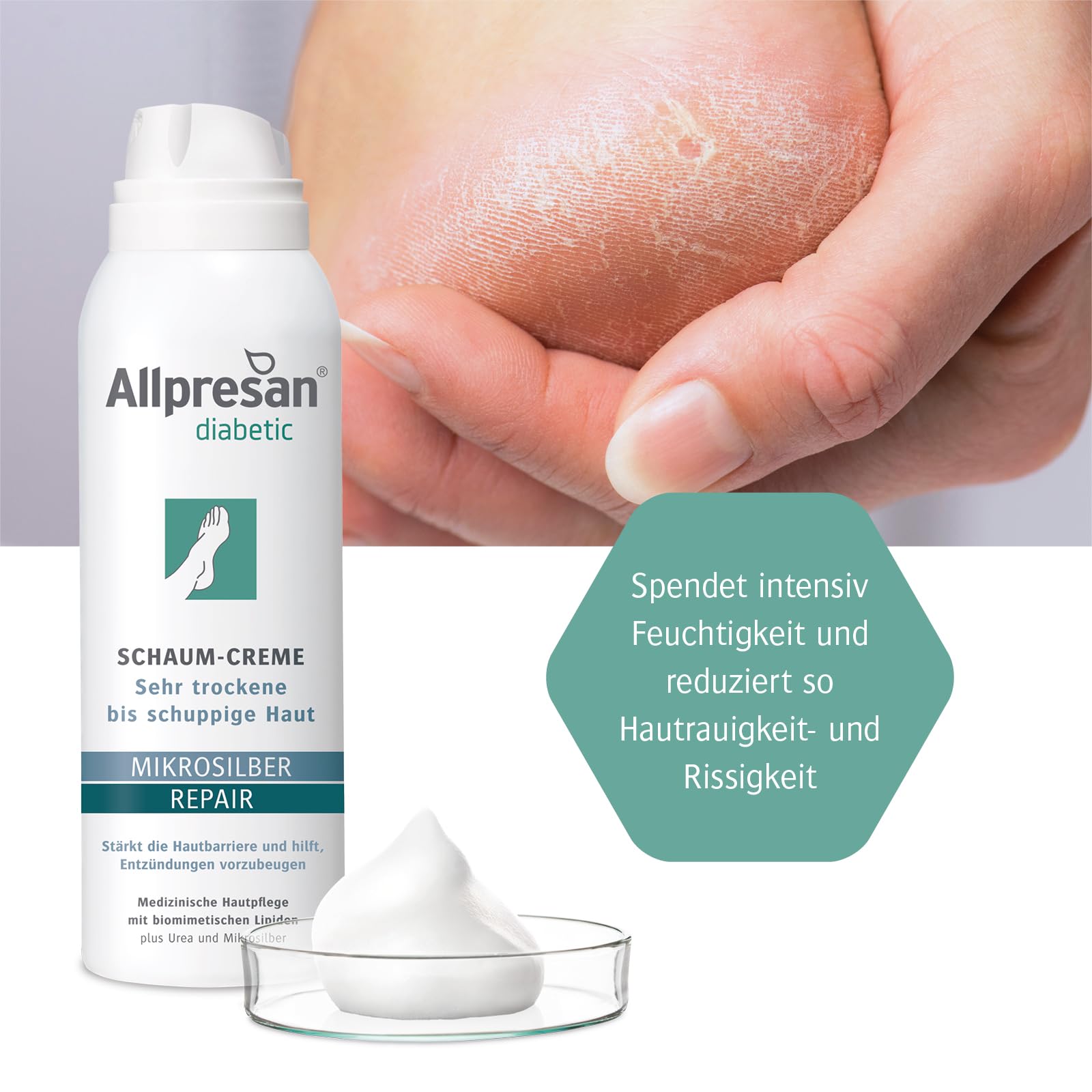 Allpresan Diabetic Microsilver+ Repair - Espuma para pies con microplata para piel muy seca a escamosa en diabetes mellitus, 125 ml (3 unidades)
