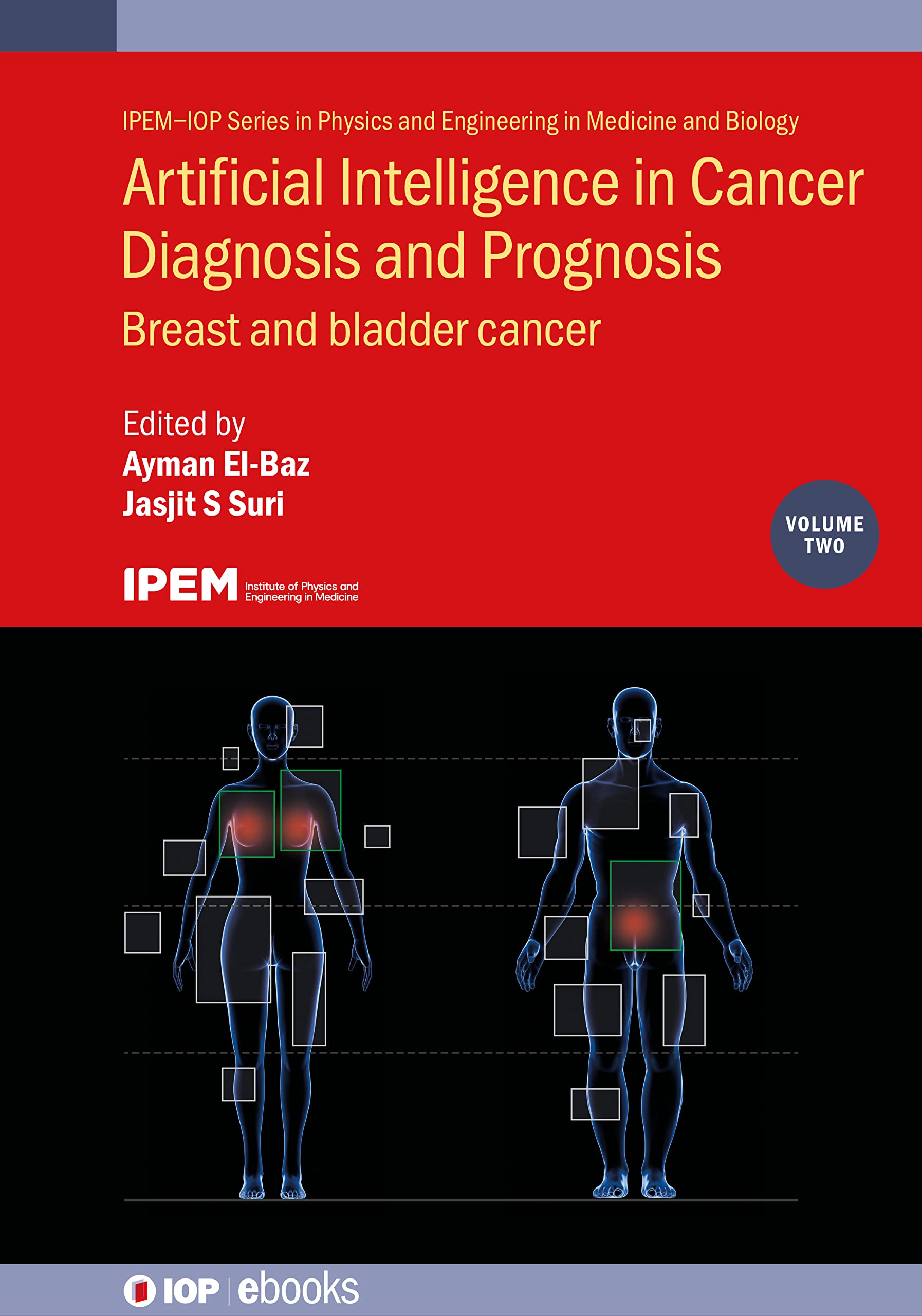 Buy Artificial Intelligence in Cancer Diagnosis and Prognosis: Breast and Bladder Cancer (Physics and Engineering in Medicine and Biology, 2) — BookShops.in