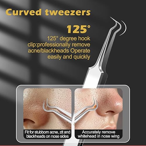 Miniatura 3 de WSYUB Pinzas profesionales para puntos negros, herramientas para quitar puntos negros,Kit de depilación encarnada