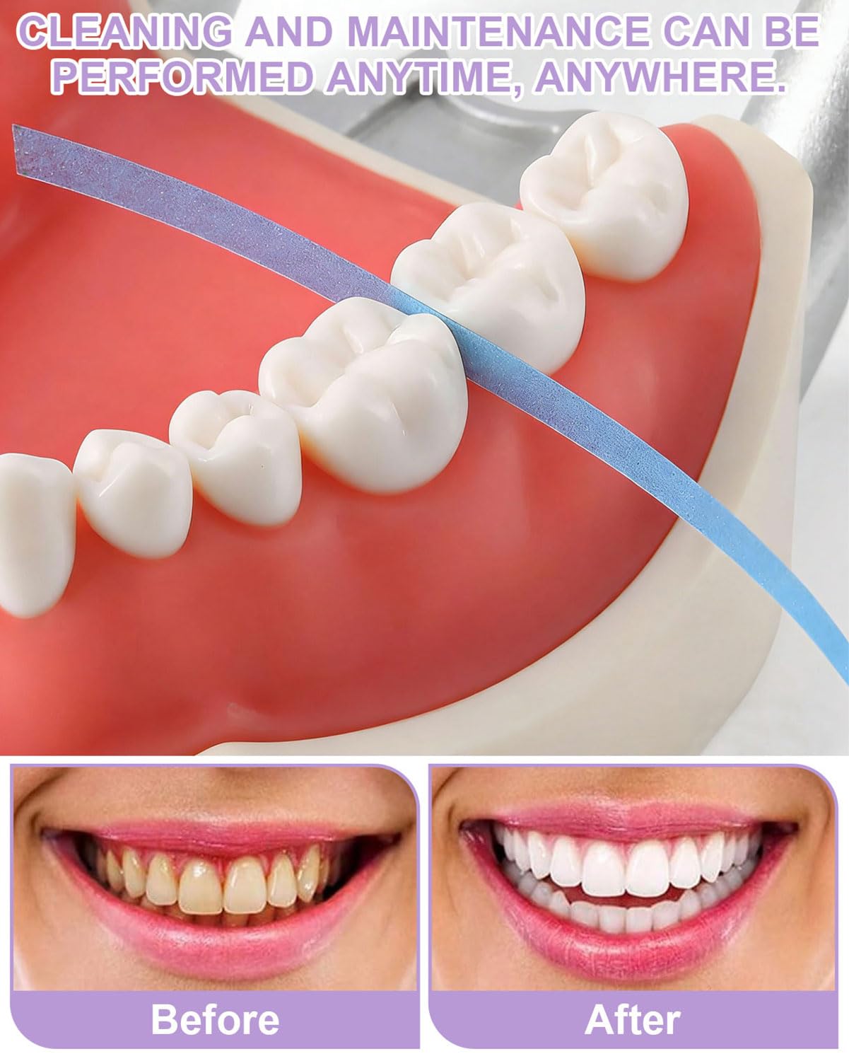 60 Pezzi Carta Vetrata Dentale,Carta Abrasiva Dentale per Fessure,Carta Abrasiva Dentale,Strisce per Lucidare i Denti Portatili,Lucidatura Dei Denti,Rimozione Del Tartaro