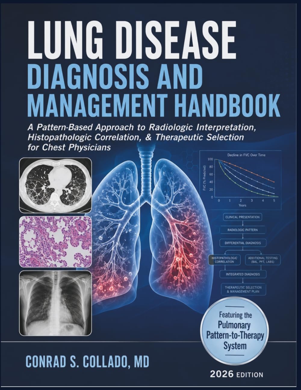 Lung Disease Diagnosis and Management Handbook: A Pattern-Based Approach to Radiologic Interpretation, Histopathologic Correlation, & Therapeutic Selection for Chest Physicians