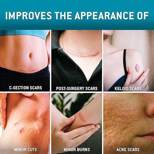 Miniatura 6 de Care Science Cinta de silicona para cicatrices de 1.6 x 120 pulgadas, 1 unidad, cinta para cicatrices quirúrgicas, queloides, eliminación de