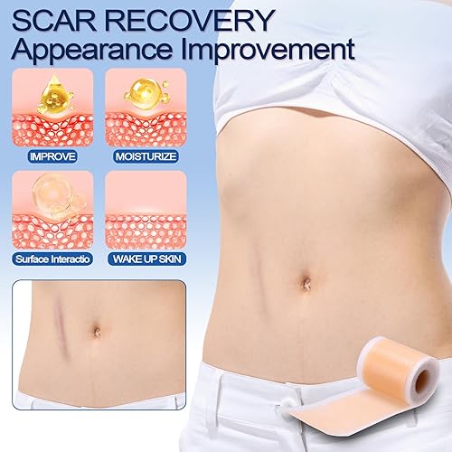 Miniatura 3 de Hojas de silicona para cicatrices y cinta para sustos quirúrgicos, sección C, abdominoplastia  Tiras de tratamiento de golpes queloides  Rollo de