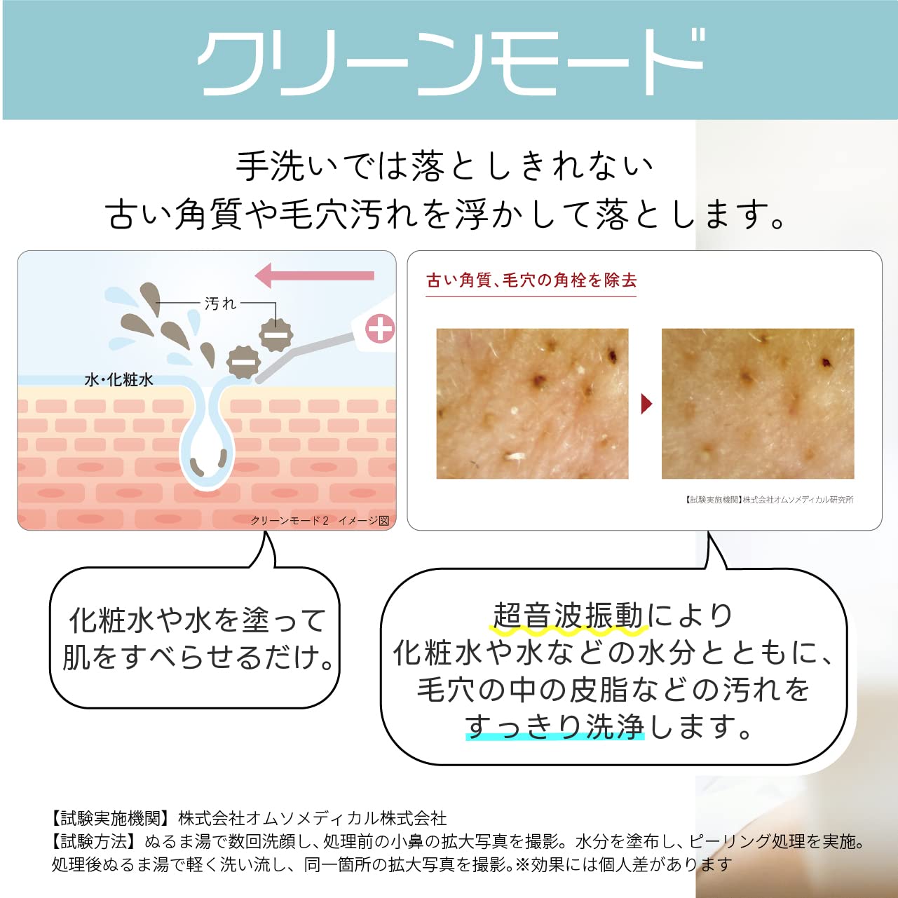 Amazon | コイズミ 超音波 ピーリング エナージュ 充電式 皮脂・角栓 