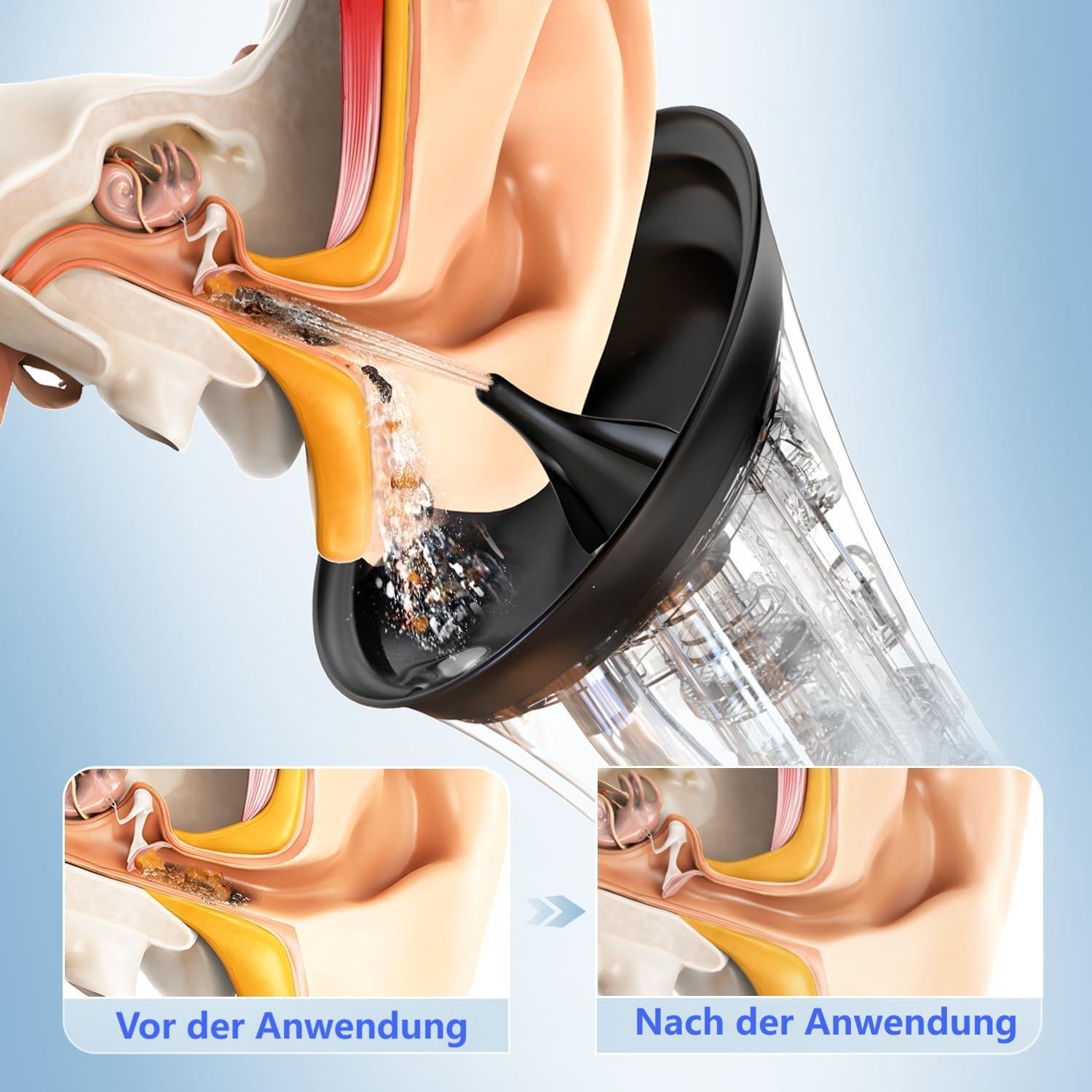 Elektrischer Ohrenreiniger für Erwachsene, Wiederaufladbare Ohrdusche mit 4 Modi & Spülfunktion, Ohrenschmalz Entferner mit IPX7 Wassertank