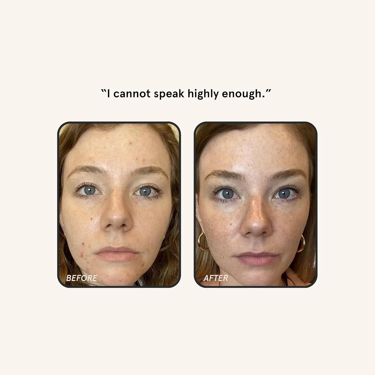 Barefaced Retinal Skin Therapy 30ml - Retinaldehyde & Bakuchiol Serum for Firming, Reducing Fine Lines & Wrinkles, Improving Skin Tone & Texture w/Shea Butter, Jojoba Oil & Argan Oil