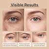 Instant Lift Eye Gel,Rapid Tightener Cream for Under Bags and Puffiness,Visibly Lifting Firming Balm Dark Circles & Fine Lines,Reduces Lines Wrinkles,for All Skin Types (1, pc)