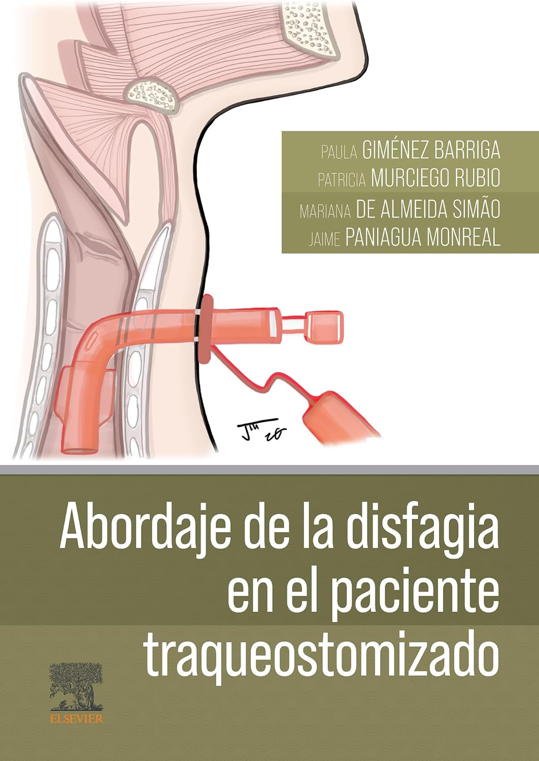 Abordaje de la disfagia en el paciente traqueostomizado (Spanish Edition)