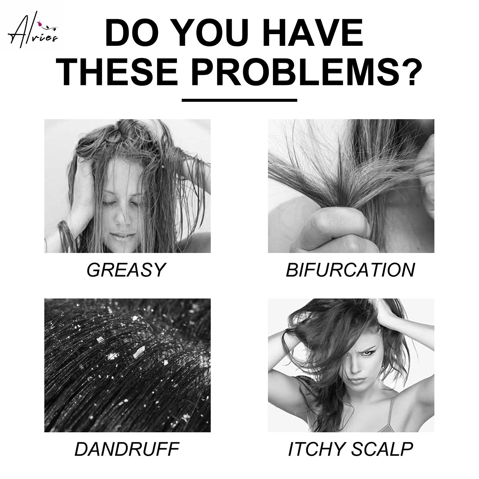 Alvies® Sulfur Deep Cleaning anti-dandruff Shampoo Size: 11.5oz 340ml, 222 ml (Pack of 1) - Image 3