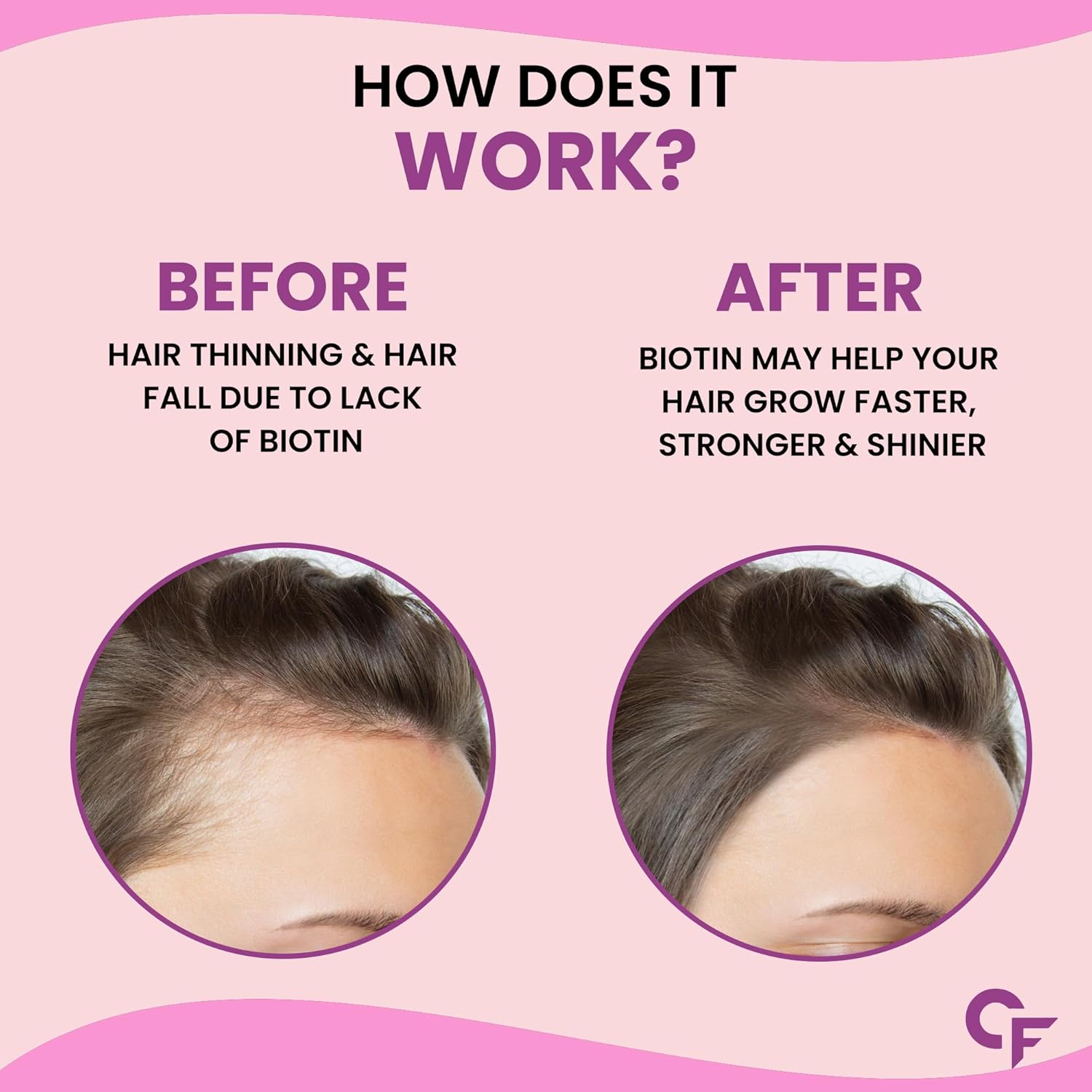 Carbamide Forte Biotin Pills for Hair Development | Biotin supplement with 50 multivitamin content for women and men. Hair supplements for women and men. Hair Growth Tablet - 90 Carbamide Forte Biotin Pills for Hair Development | Biotin supplement with 50 multivitamin content for women and men. Hair supplements for women and men. Hair Growth Tablet - 90