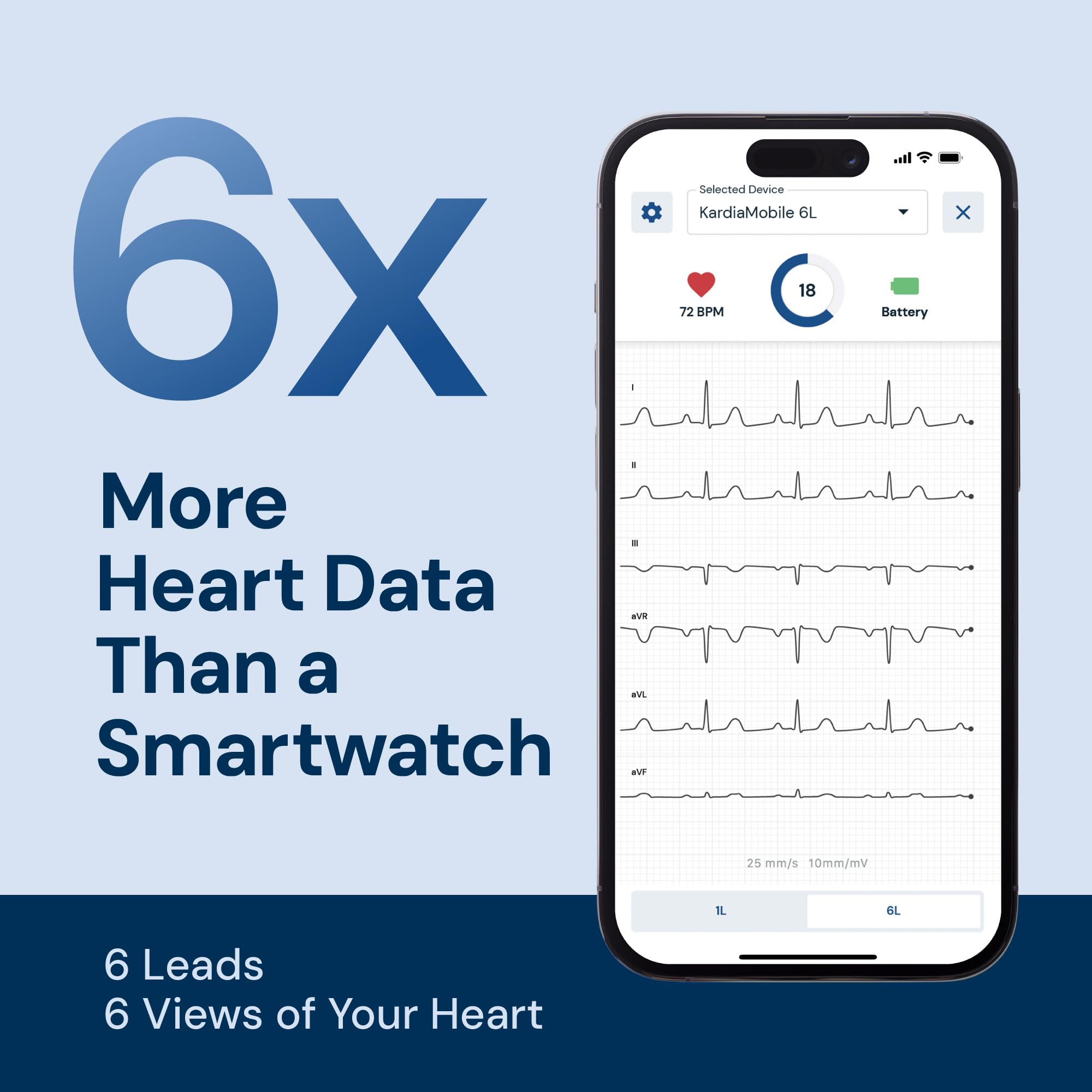 Kardiamobile Electrocardiografo Portatil de 6 derivaciones – Detecta fibrilación Auricular – Resultados instantáneos en 30 Segundos – Funciona con la mayoría de los Smartphones