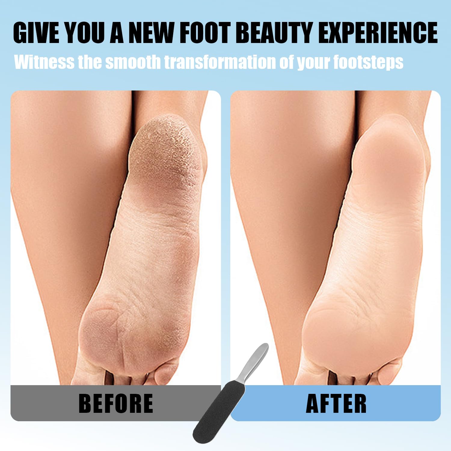 SYEYCW 1 Pcs Stainless Steel Handle, 20 Pcs Foot File Coarse Fine Grit Pads - Image 4