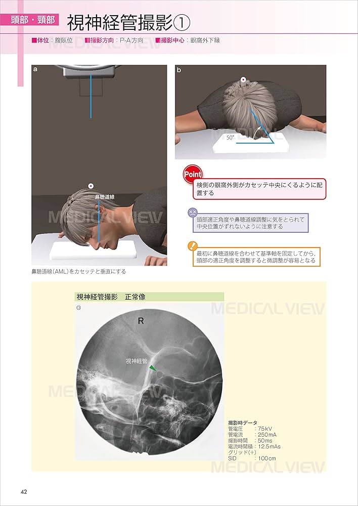 X線撮影法 中村貴 著 X線撮影法 中村貴 著