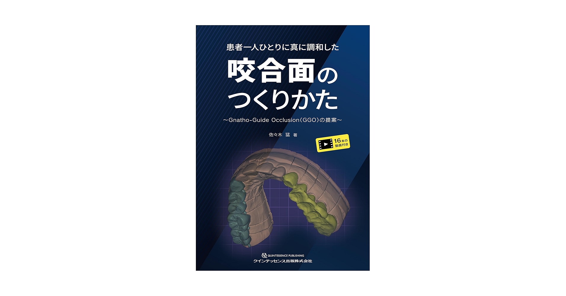 患者一人ひとりに真に調和した咬合面のつくりかた: Gnatho-Guide Occlusion(GGO)の提案 Amazon.co.jp: 患者一人ひとりに真に調和した咬合面のつくりかた