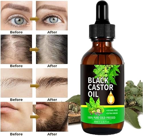 Miniatura 3 de Aceite de Ricino 100 Puro y Natural, Aceite de Castor Orgánico Puro, Aceite para El Cabello para Pestañas, Cejas, Encrespado, Crecimientodel Vello