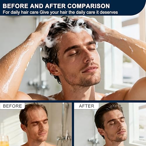 Miniatura 4 de Champú activador de raíces para el crecimiento del cabello, pérdida de cabello y adelgazamiento del cabello, champú espesante con extractos de