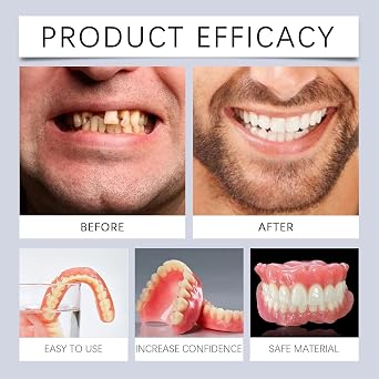 Silicone Reline Denture Set, Silicone Denture Set, Soft Silicone Denture Reline Kit, Denture Set, Veneers Snap in Teeth (1pcs)