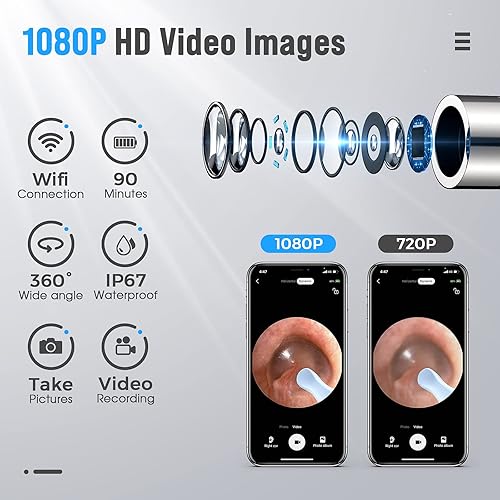 Miniatura 3 de Kit de eliminación de cera de oído, kit de eliminación de cera de oídos con 1080P HD, limpiador de oídos con cámara y luz, kit de limpieza de oídos