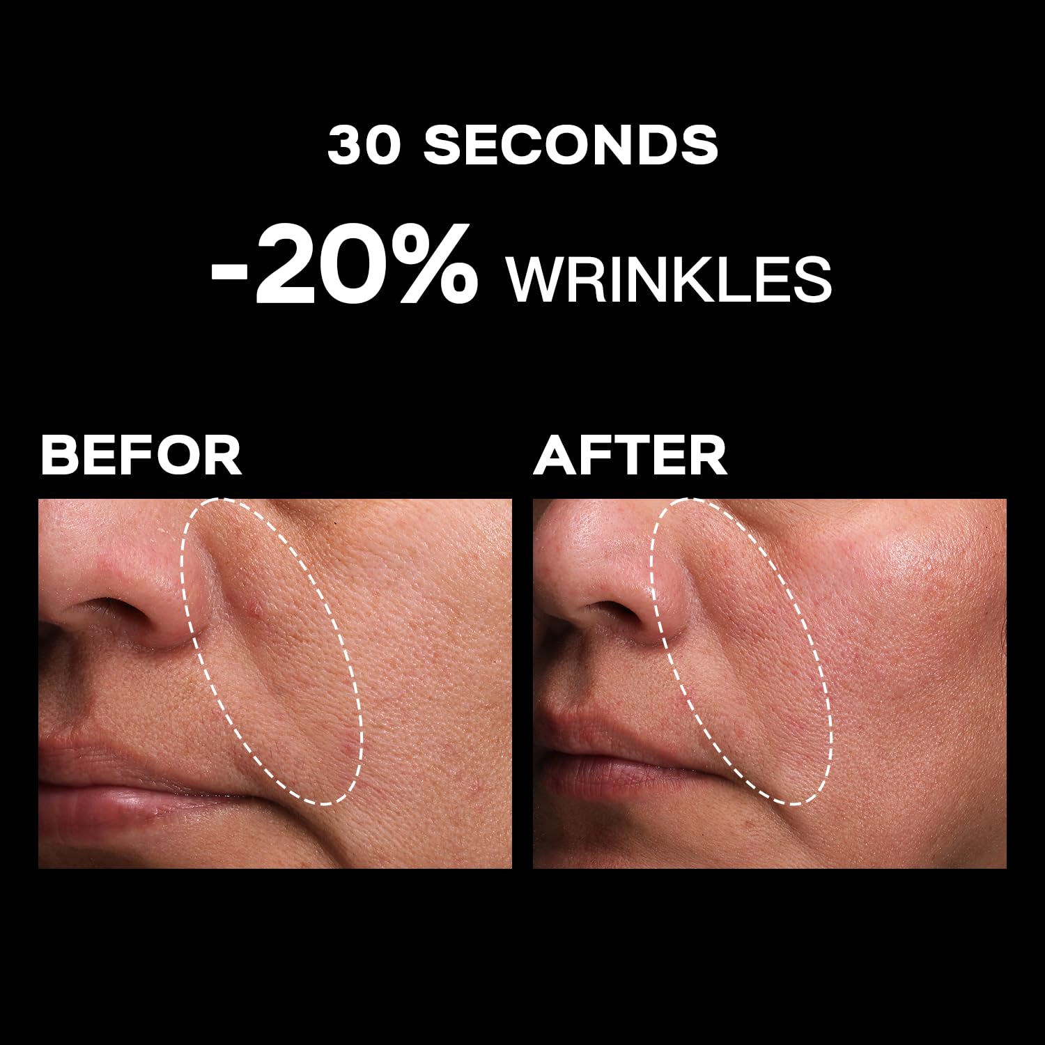 Moritek Ultimate Mori-Lift Mist 30ml : Amazon.co.uk: Beauty