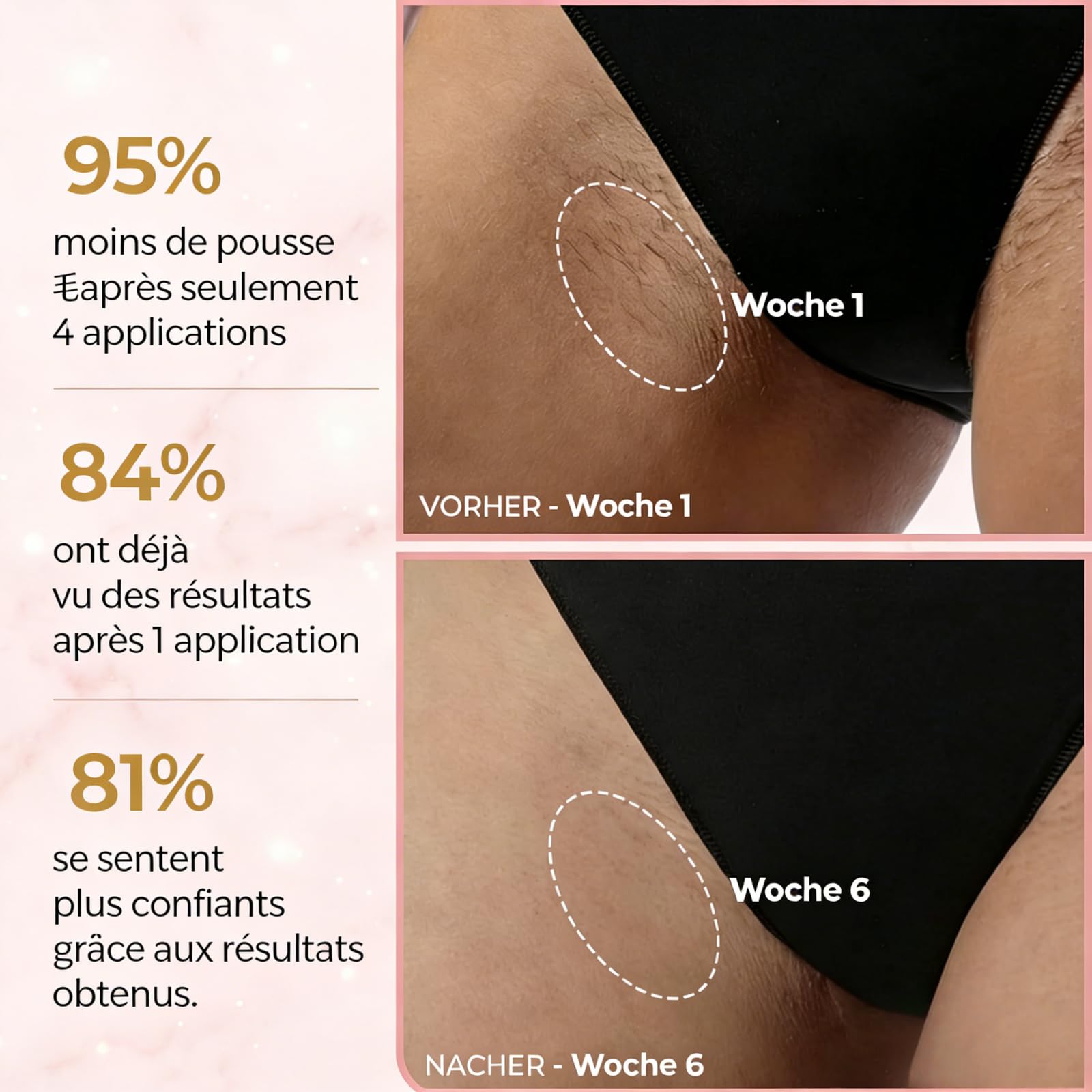 ARYA LUSH IPL Pulse・Pulsed Light Hair Removal, épilation indolore, épilateur lumière pulsée pour hommes femmes,5 niveaux d'énergie 2 modes,visage corps bikini aisselles, peau soyeuse efficace (Black)
