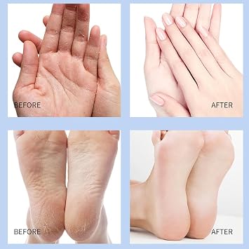 Foot Care Cream Heel and Foot Balm for Remove Callus, Instant Peeling, Remove Dead Skin And Softening Dry Skin(2pcs, Blue+Pink)