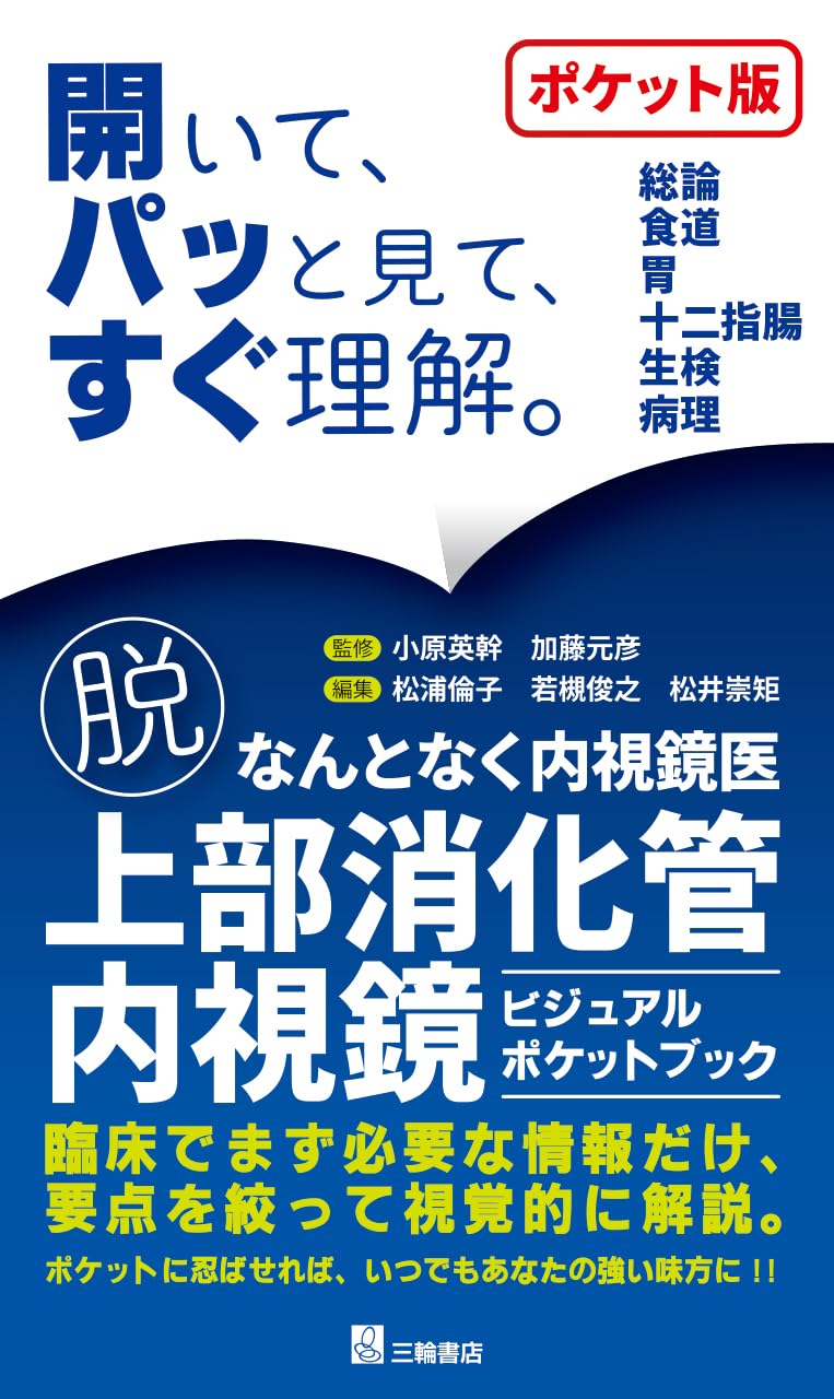 脱・なんとなく内視鏡医 上部消化管内視鏡ビジュアルポケットブック