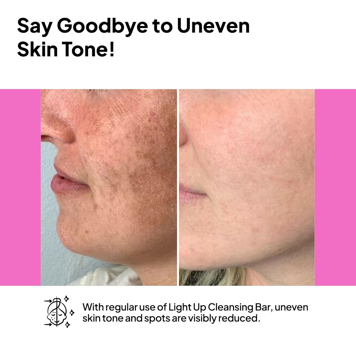 pH Lab Light Up Anti-Spot Serum, Even Skin Tone, Clean Pores, Help Prevent Blemish Formation, 1.01 Fl Oz (Pack of 1) - Image 8