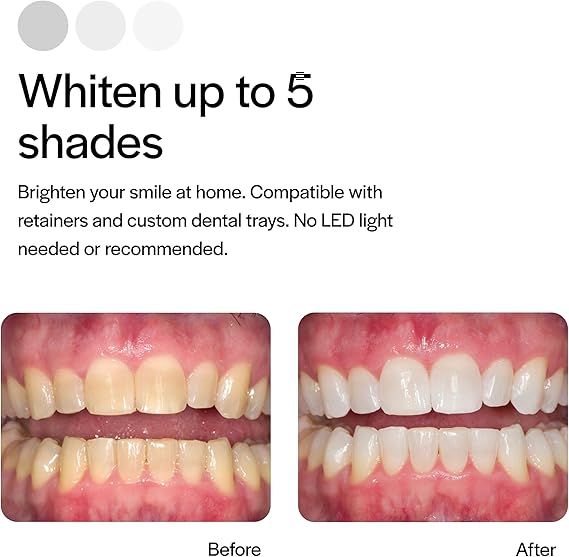 Opalescence 15% Gel Syringes Teeth Whitening Refill Kit - Low Sensitivity (4 Syringes) - Cool Mint - Carbamide Peroxide - Made in The USA by Ultradent Tooth Whitening - 5195-2