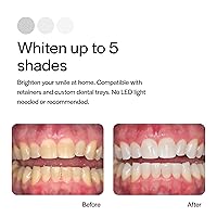 Vista 4 de Opalescence 20% jeringas de gel blanqueador dental - Kit de recarga (12 jeringas) peróxido de carbamida. Fabricado por Ultradent, en sabor menta.