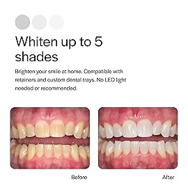 Opalescence 20% Teeth Whitening Refill Kit (4 Syringes) Carbamide Peroxide. Made by Ultradent, in Mint Flavor. Tooth Whitening Refill Syringes - B-5196-4