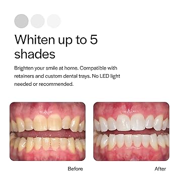 Opalescence 10% Teeth Whitening Kit - Gel Syringes Refills - Low Sensitivy (8 Units) - Fluoride, Carbamide Peroxide - Made in The USA by Ultradent 5211-4