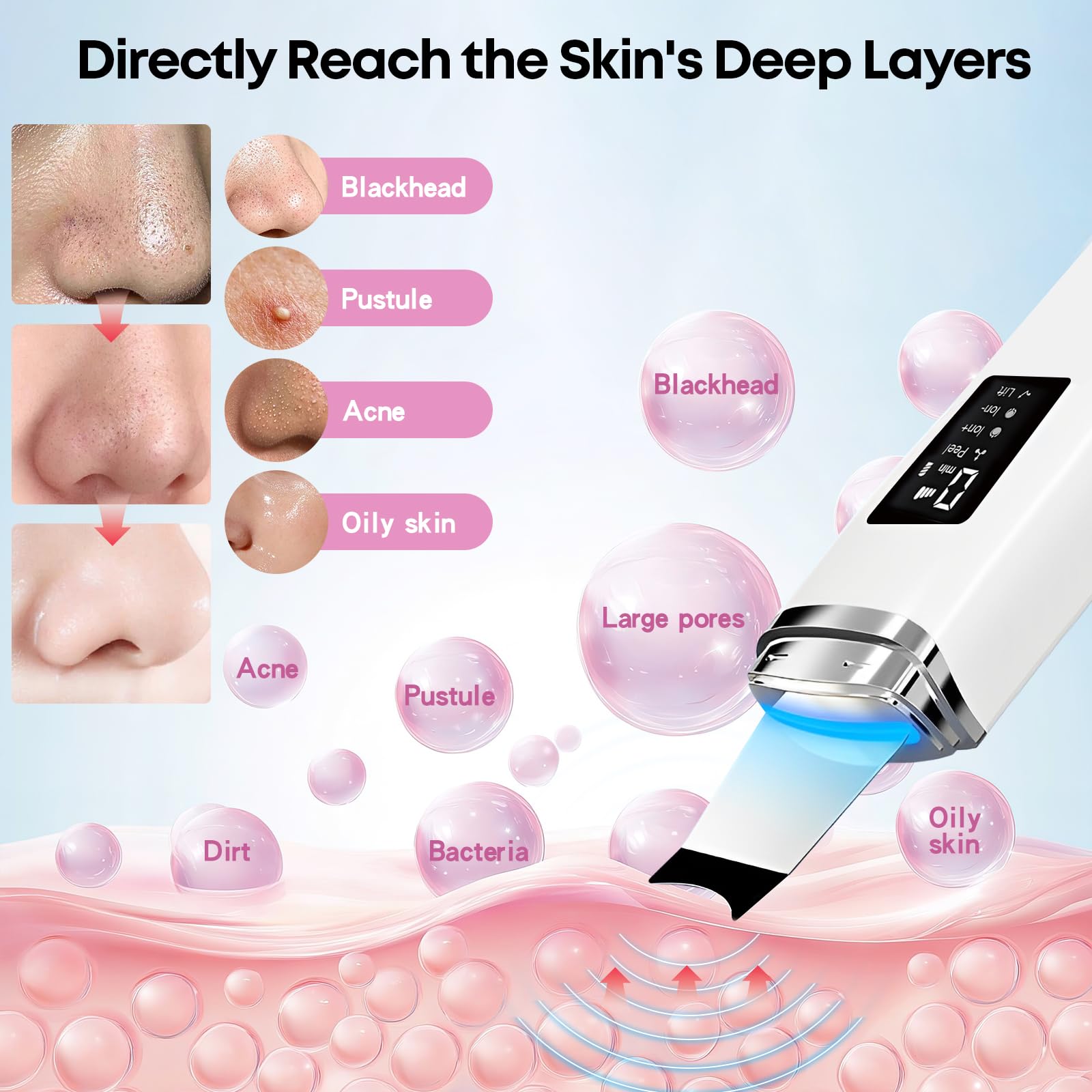 Peeling Ultrasónico Facial, Limpiador Ultrasonidos Facial, 4 Modos e Intensidad Ajustable, Extractores de puntos negros, Skin Scrubber Removedor de Puntos Negros para Dispositivo de Belleza