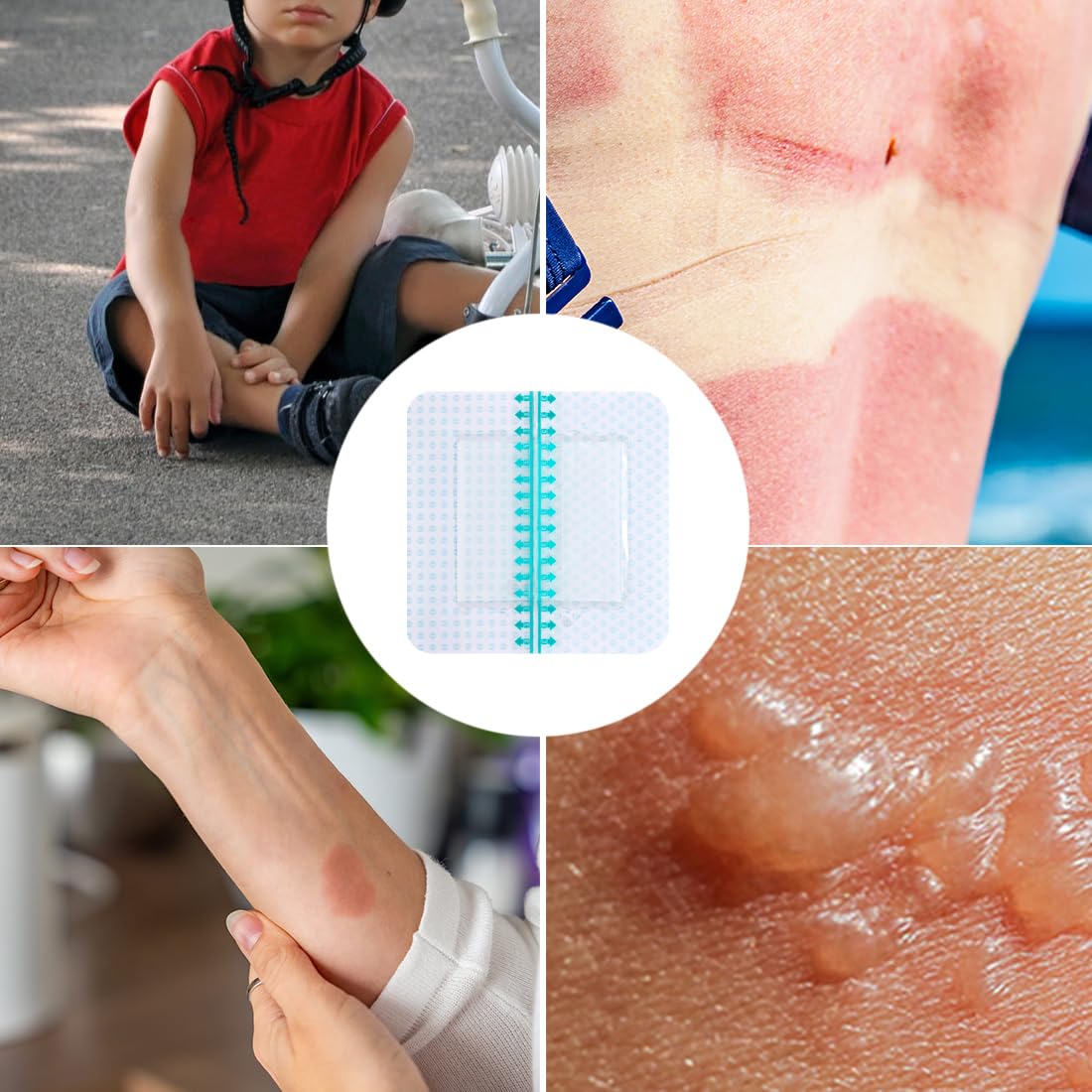 Hydrogel Burn Dressing with Border 4"x4" Self-Adhesive Waterproof Hydrocolloid Wound Dressings Patch Bandages Relief for Minor Burns, Cuts & Abrasions Pack of 5 — Amazon image 6