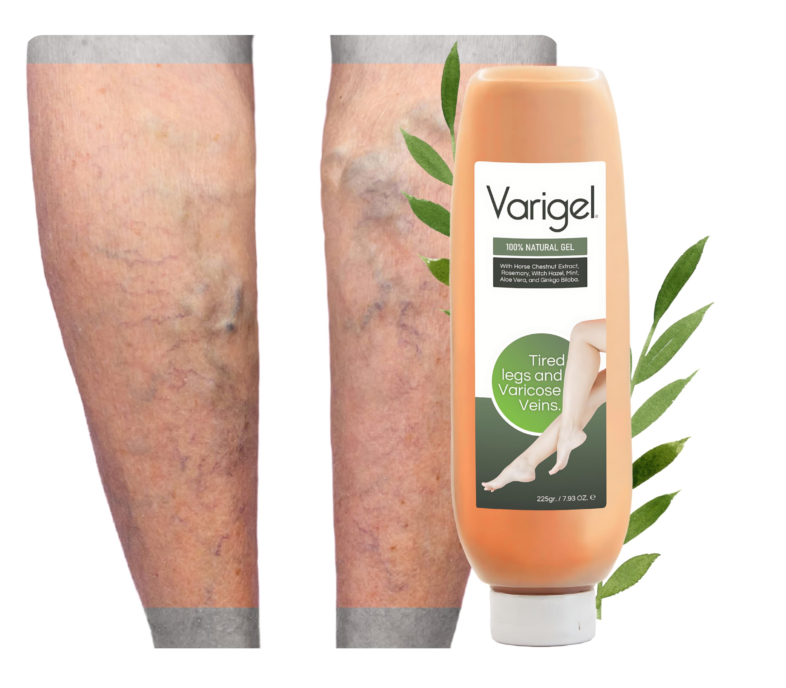 Sin Dolor Varigel - 100% Natural Relaxing Gel for Varicose Veins, Tired Legs, and Spider Veins - Assists with Poor Circulation and Varicose Veins - With Rosemary, Witch Hazel, Mint, and Aloe Vera