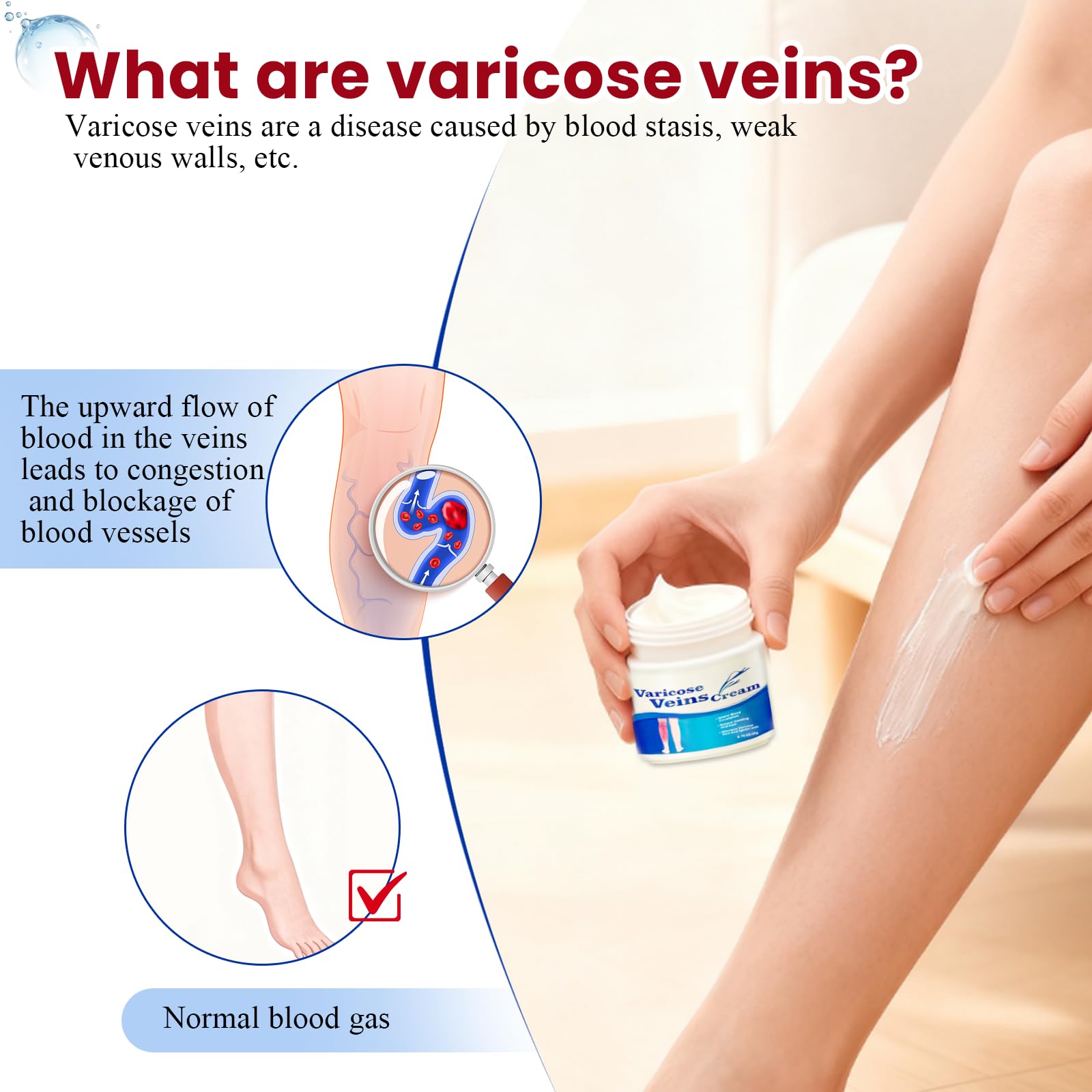 20g Crème pour Les Varices,Soulage Rapidement Les Jambes Fatiguées Et Lourdes,Facile à Utiliser