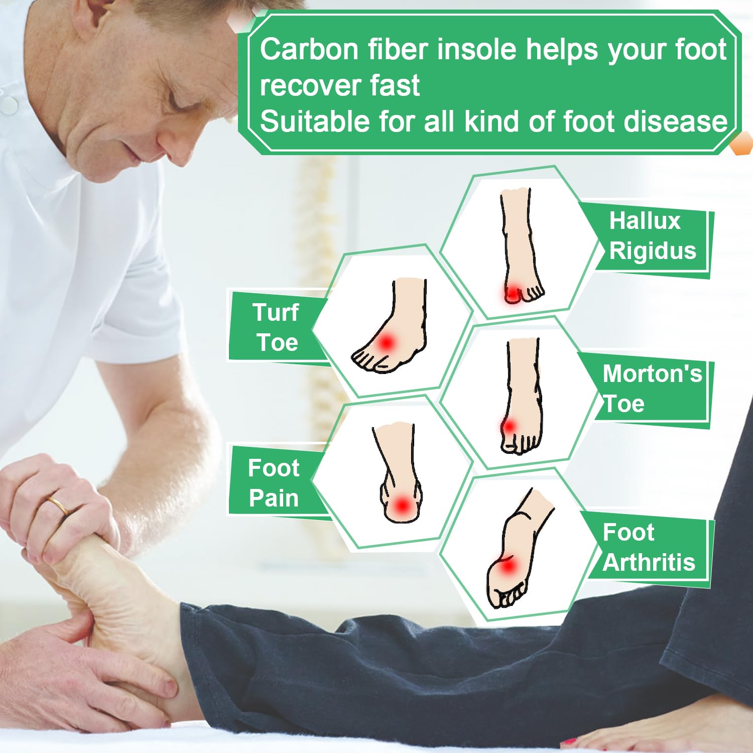 Plantilla de fibra de carbono, extensión ortopédica Morton, 1 par de plantillas ortopédicas rígidas para dedos de césped, artritis del pie, hallux rígido, para recuperación del dolor (10.04-255 mm,
