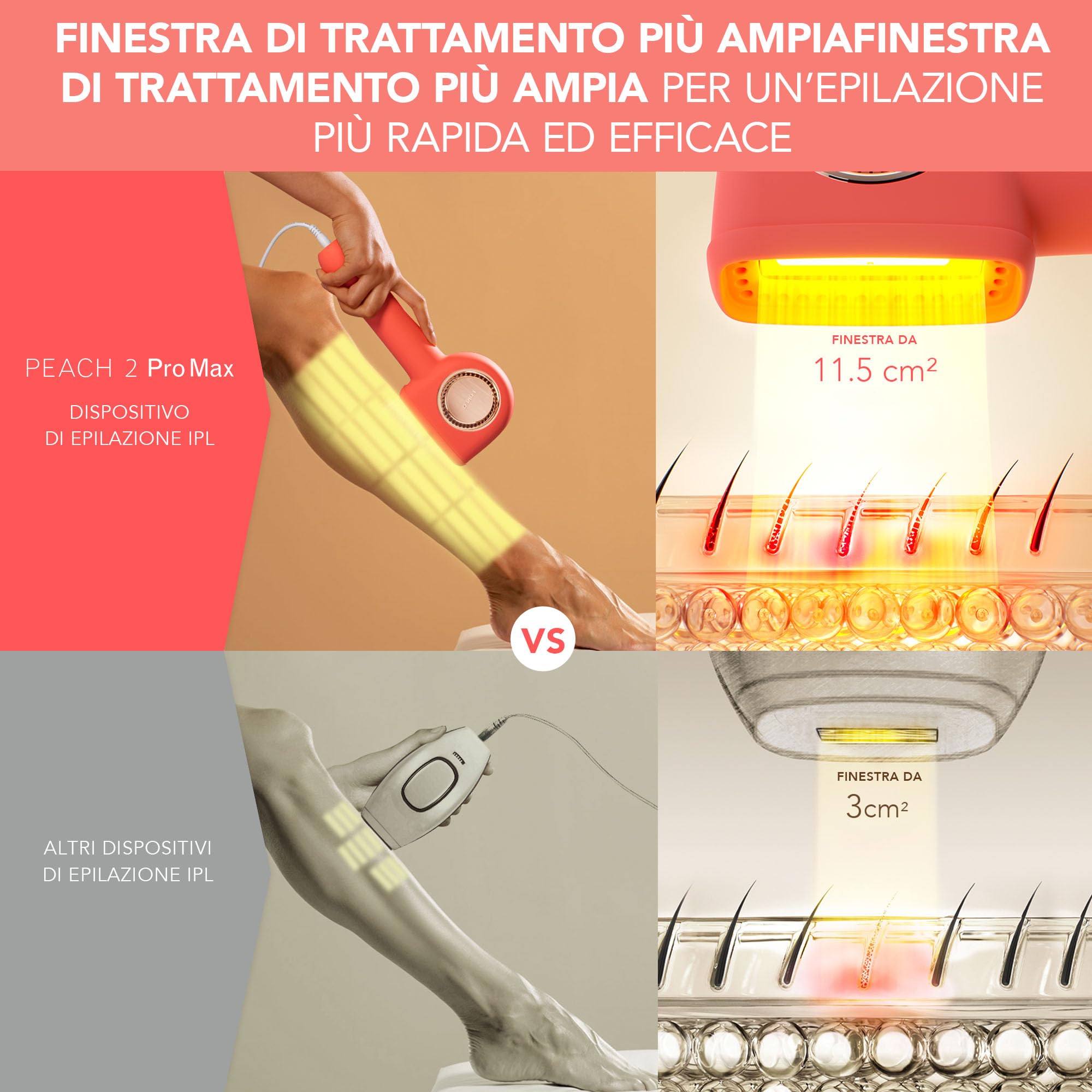 FOREO PEACH 2 Pro Max epilatore luce pulsata, depilatore corpo donna, uomo. Depilazione uomo, donna con epilazione IPL avanzata per viso, corpo. Pelle liscia, risultati duraturi