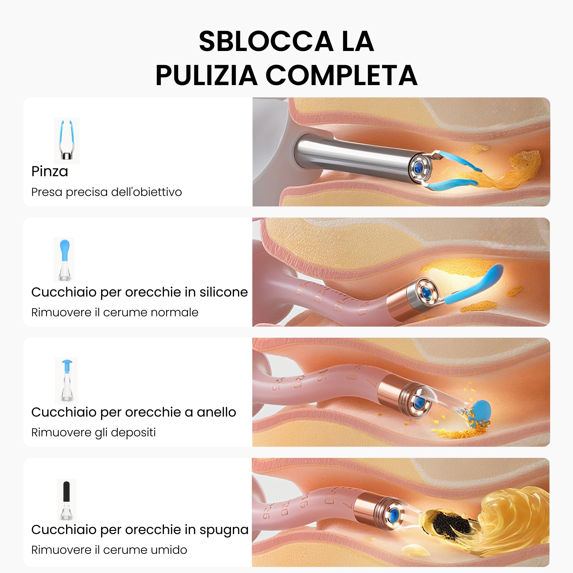 Bebird Pro Earsight Plus Otoscope, nettoyeur d'oreilles HD 1920p avec caméra, lumière, étui portable, rose
