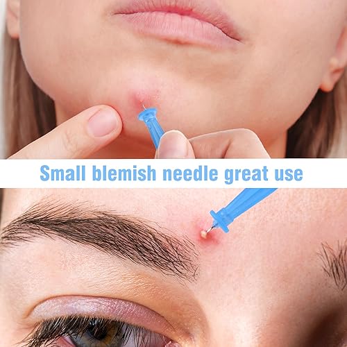 Miniatura 4 de AUSLKA Kit de herramientas profesionales de agujas de imperfecciones, 250 piezas, herramientas desechables para eliminar manchas y almohadillas de