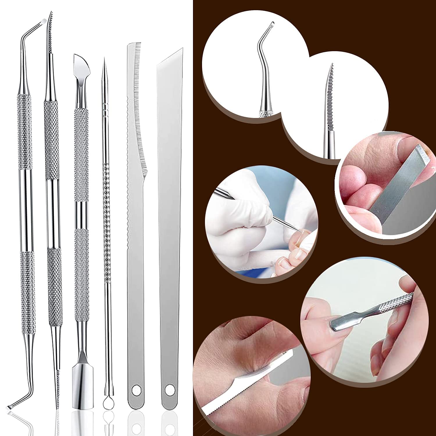 kit de Traitement des Ongles Incarnés – Pince à Ongles Incarnés et Outils de Correction avec Instruments en Acier Inoxydable