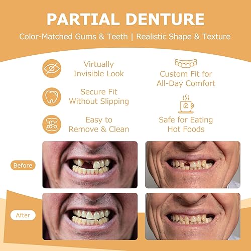 Miniatura 4 de Prótesis parciales – Dentaduras postizas para dientes perdidos y huecos – Dientes de repuesto ligeros e irrompibles para hombres y mujeres (1 diente)