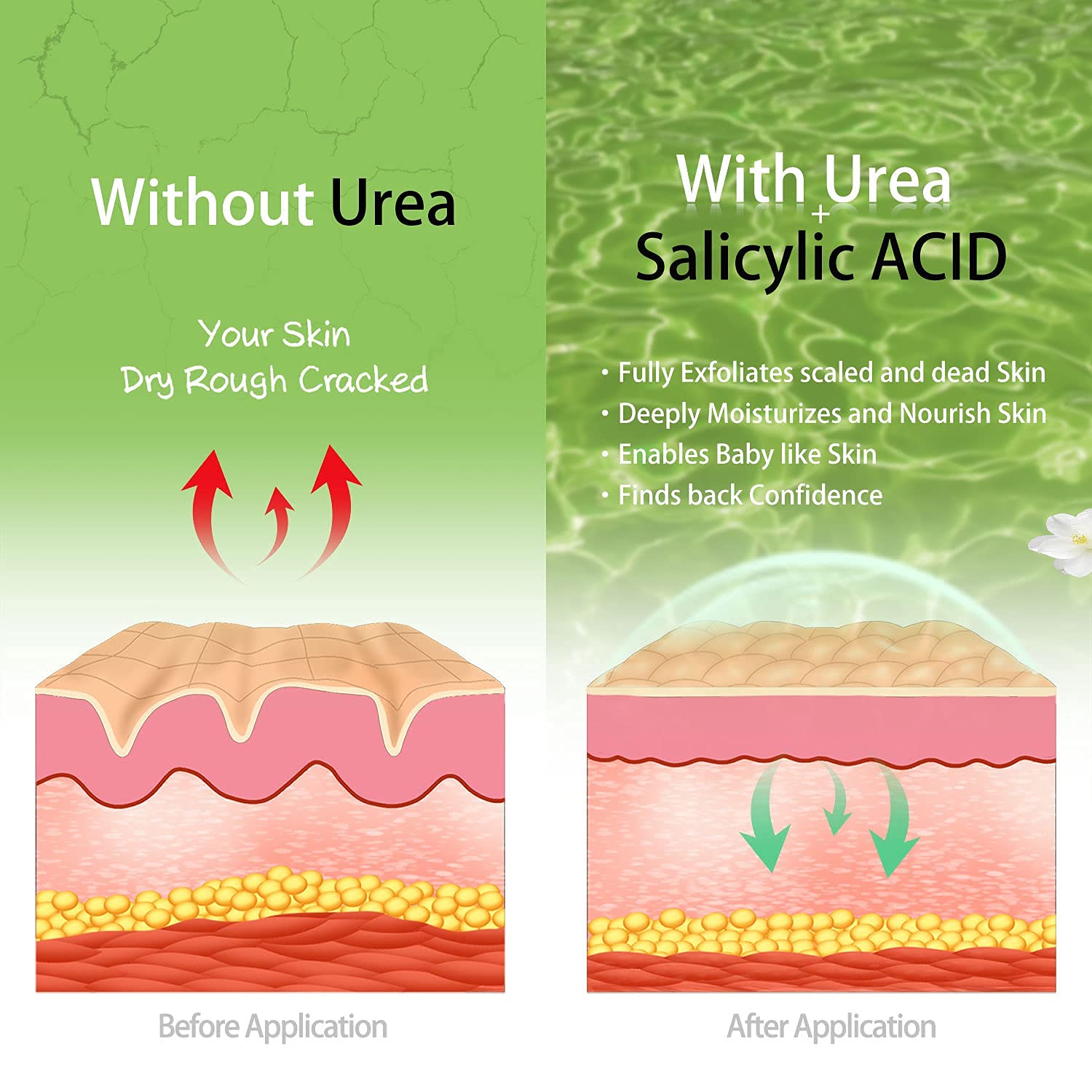 Urea Skin Before After ubicaciondepersonas.cdmx.gob.mx