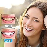 Vista 7 de 3 piezas de herramientas dentales, púas dentales profesionales para limpieza de dientes, removedor de placa de acero inoxidable quirúrgico 304 100%