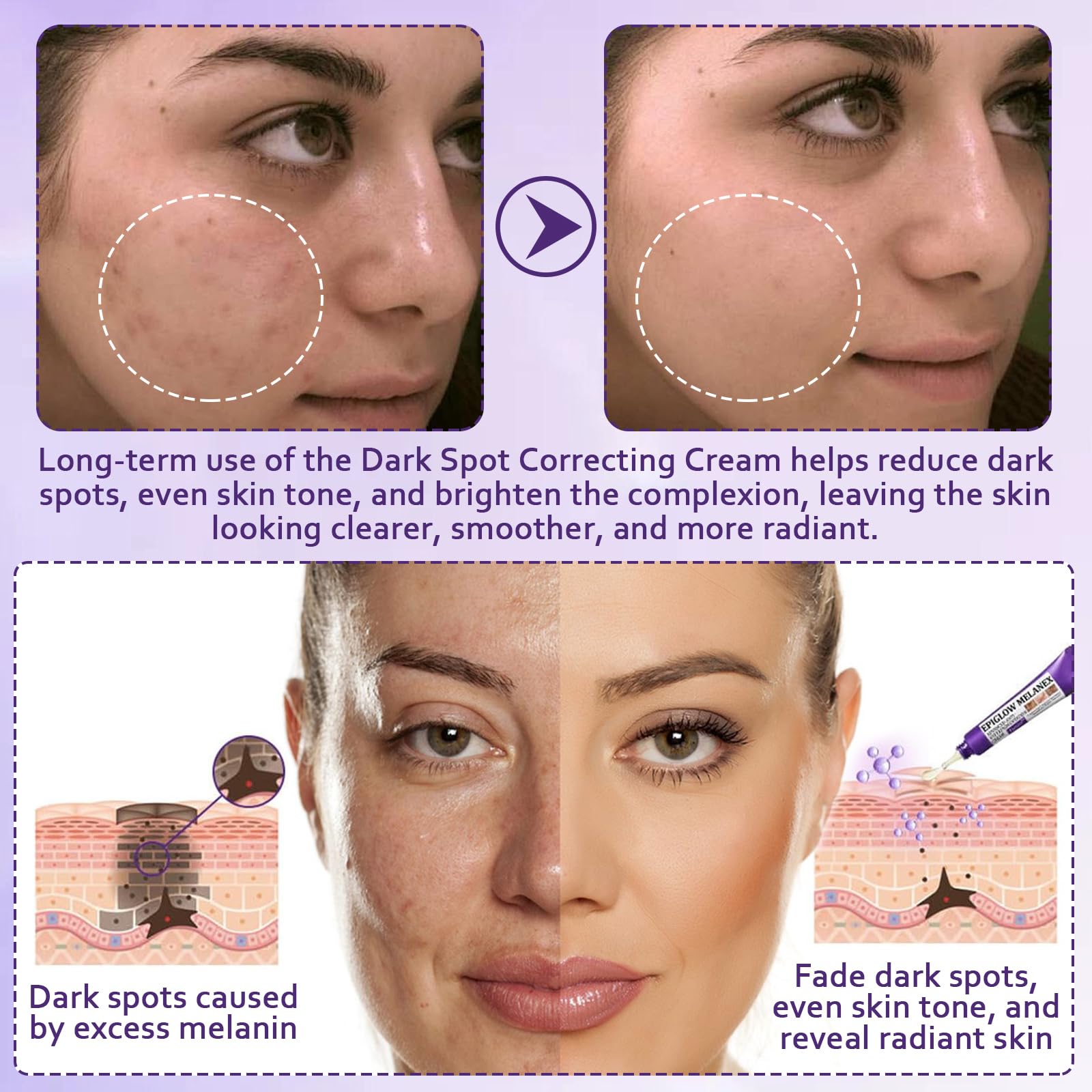 GMHLLES 2 Bottles of Anti-Hyperpigmentation Cream, Dark Spot Cream, with 1 Pair of Eye Patches, Nourishing and Moisturizing - Image 3