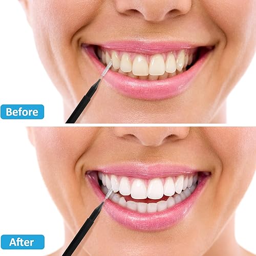 Miniatura 154 de Patelai 100 piezas de cepillos para limpiador, cepillo interdental, palillo de dientes, cabezal de hilo dental, hilo dental, higiene dental, hilo