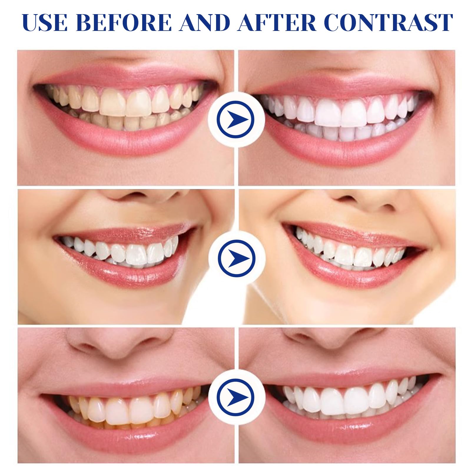 Lapiz Blanqueador Dental, 2 Piezas Gel Blanqueador de Dientes, Profesional Blanqueamiento Dental Efectivo, Sin Sensibilidad Eliminar Las Manchas Dentales