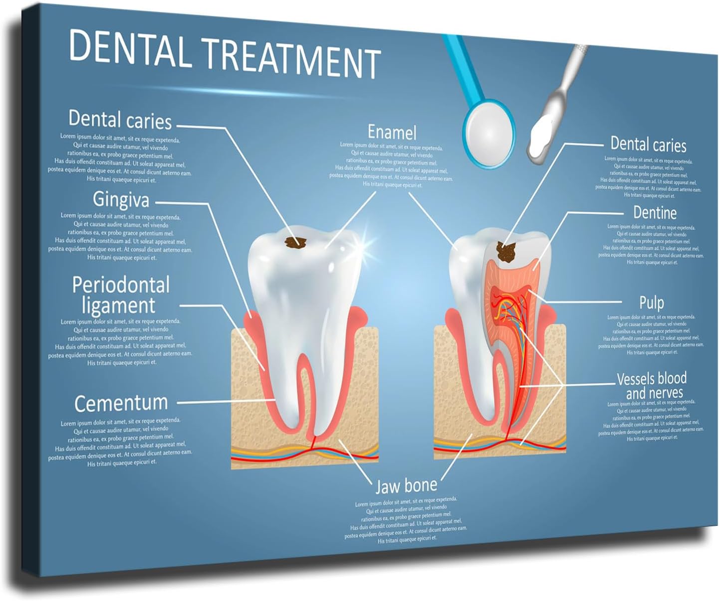 Vector Dental Anatomy and Tooth Structure Diagram Poster Modern Family Bedroom Office Background Wall Art HD Picture Canvas Printing Artwork Decor Posters (24×36inch-Framed)